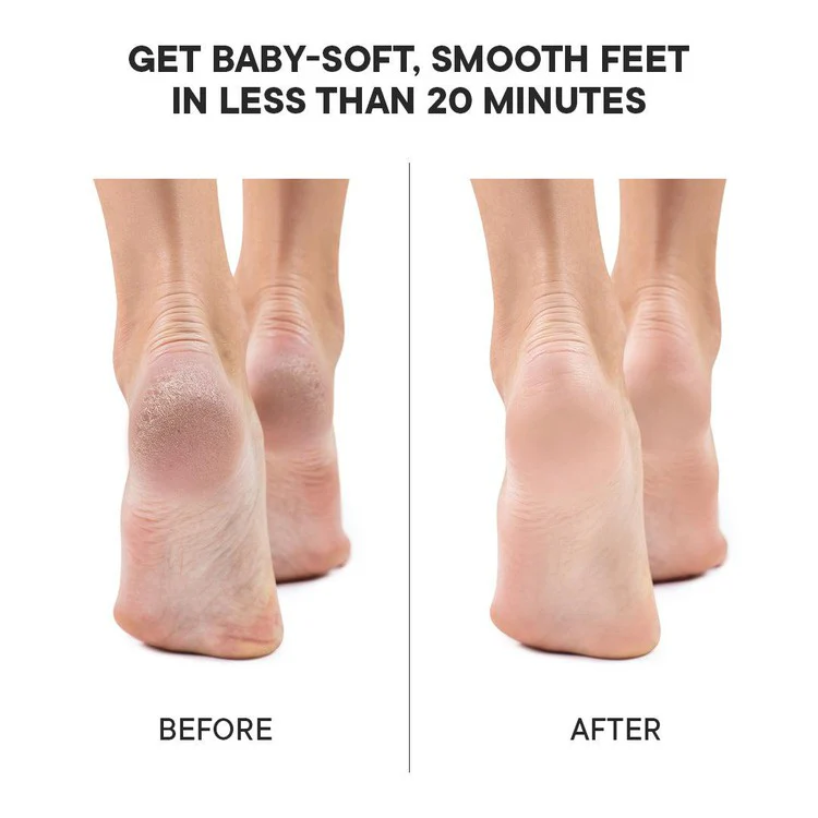 Pedicure Foot Mask with Matcha Green Tea - Image 6